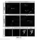 Fig. 15 - Gene and cell therapy using cell fusion technology