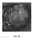 Fig. 03 - INJECTABLE HYDROGELS AND APPLICATIONS THEREOF