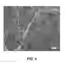 Fig. 08 - INJECTABLE HYDROGELS AND APPLICATIONS THEREOF