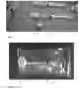 Fig. 02 - Malleable demineralized bone composition and method of manufacture