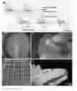 Fig. 01 - PRINTABLE MORPHOGENETIC PHASE-SPECIFIC CHITOSAN-CALCIUM-POLYPHOSPHATE SCAFFOLD FOR BONE REPAIR