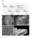 Fig. 02 - PRINTABLE MORPHOGENETIC PHASE-SPECIFIC CHITOSAN-CALCIUM-POLYPHOSPHATE SCAFFOLD FOR BONE REPAIR