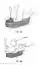 Fig. 07 - Medical device