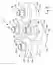 Fig. 04 - Redundant-impeller artificial heart