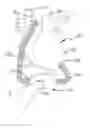Fig. 01 - Ventricular assist device