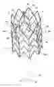 Fig. 01 - IMPLANTABLE INTRAVASCULAR VENTRICULAR ASSIST DEVICE