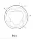 Fig. 04 - IMPLANTABLE INTRAVASCULAR VENTRICULAR ASSIST DEVICE