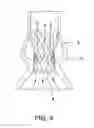 Fig. 05 - IMPLANTABLE INTRAVASCULAR VENTRICULAR ASSIST DEVICE