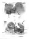 Fig. 09 - Sterile patch pump