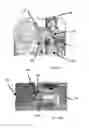Fig. 13 - Sterile patch pump