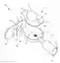 Fig. 01 - SINGLE USE DELIVERY DEVICE
