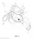 Fig. 02 - SINGLE USE DELIVERY DEVICE