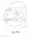 Fig. 41 - Cushion for a respiratory mask assembly