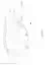 Fig. 02 - Ventilation mask