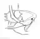 Fig. 08 - Atraumatic medical device
