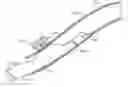 Fig. 01 - Dual modulus balloon for interventional procedures