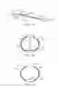 Fig. 02 - Dual modulus balloon for interventional procedures