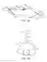 Fig. 03 - Dual modulus balloon for interventional procedures