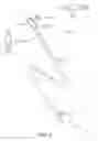 Fig. 06 - Dual modulus balloon for interventional procedures