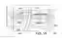 Fig. 16 - Catheter systems and packaged kits for dual layer guide tubes