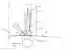 Fig. 01 - Device and method for automated emergency arterial sheath placement