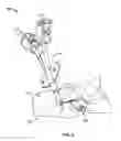 Fig. 05 - Systems and methods for anchoring medical devices