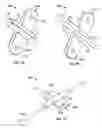 Fig. 08 - Systems and methods for anchoring medical devices