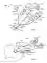 Fig. 10 - Systems and methods for anchoring medical devices