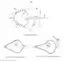 Fig. 02 - Balloon catheter and fluid management system thereof