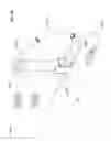 Fig. 35 - Balloon catheter and fluid management system thereof