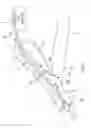 Fig. 02 - Systems and methods for treatment of fluid overload