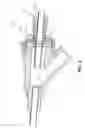 Fig. 03 - Securing a medical device to a valve instrument