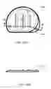 Fig. 158 - Infusion Pump Assembly