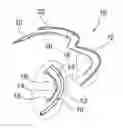 Fig. 01 - System implantable into the coronary venous network for the stimulation of a cardiac left cavity