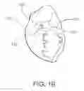Fig. 03 - Devices and systems for accessing cardiac tissue