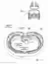 Fig. 12 - Systems and methods to place one or more leads in tissue for providing functional and/or therapeutic stimulation
