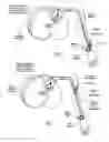 Fig. 17 - Systems and methods to place one or more leads in tissue for providing functional and/or therapeutic stimulation