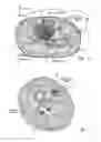 Fig. 25 - Systems and methods to place one or more leads in tissue for providing functional and/or therapeutic stimulation