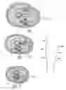 Fig. 26 - Systems and methods to place one or more leads in tissue for providing functional and/or therapeutic stimulation