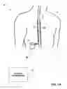 Fig. 02 - Posture state redefinition based on posture data