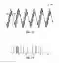Fig. 09 - PATTERNED STIMULATION FOR DEEP BRAIN STIMULATION