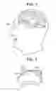 Fig. 02 - Trans-orbital infrared light therapy