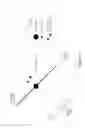 Fig. 04 - PARTIAL VIEW INTERFRACTION TREATMENT TARGET MOTION MANAGEMENT USING VOLUMETRIC IMAGING