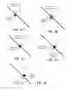 Fig. 07 - No-view interfraction treatment target motion management using volumetric imaging