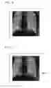 Fig. 06 - Medical image processing apparatus, treatment system, medical image processing method, and medical image processing program