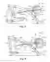 Fig. 07 - Exercise apparatus