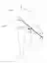 Fig. 02 - Carrying ski equipment