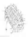 Fig. 02 - Unitarily formed expandable spinal implant and method of manufacturing and implanting same