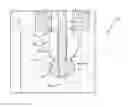 Fig. 01 - FLUID APPLICATOR HAVING A VALVE MODULE WITH A FLOATING MEMBER AND THE VALVE MODULE