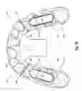 Fig. 05 - Mold with separable features